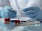 DR Kongo-d&ouml;dssiffran f&ouml;r ebolautbrott &ouml;kar med 131 rapporterade d&ouml;dsoffer nu